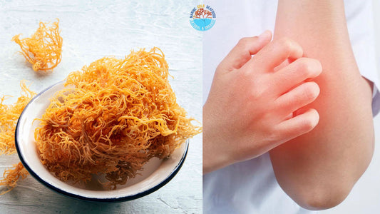 Sea Moss Benefits and Allergies : Learn Now